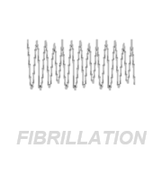 fibrillation